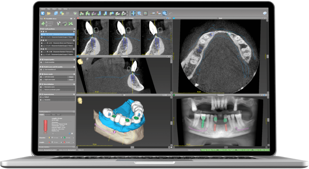 coDiagnostiX® demo