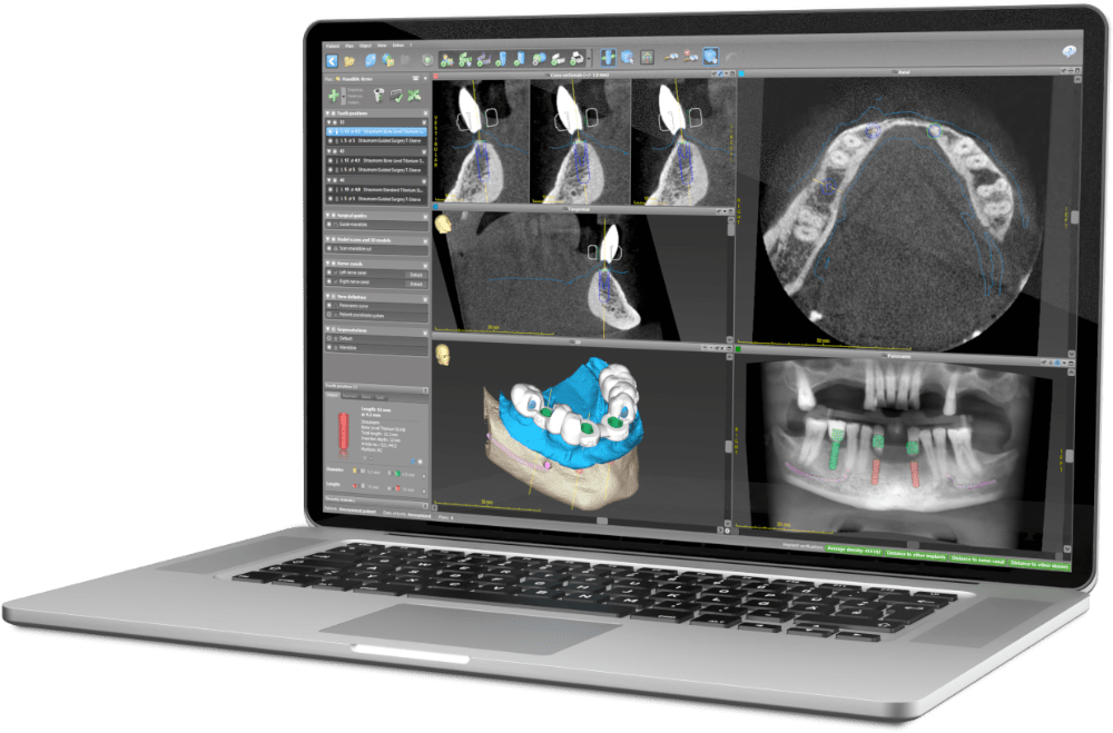 coDiagnostiX® demo